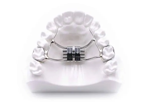 Children's orthodontics in Riga, jaw expansion