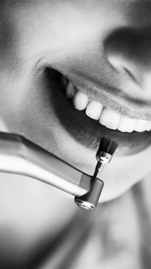 Professional teeth cleaning: is it actually necessary or just marketing?